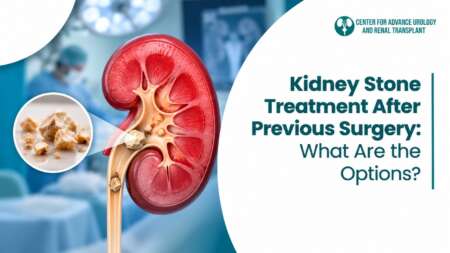 Kidney stone treatment options after previous surgery including RIRS Mini-PCNL and ECIRS