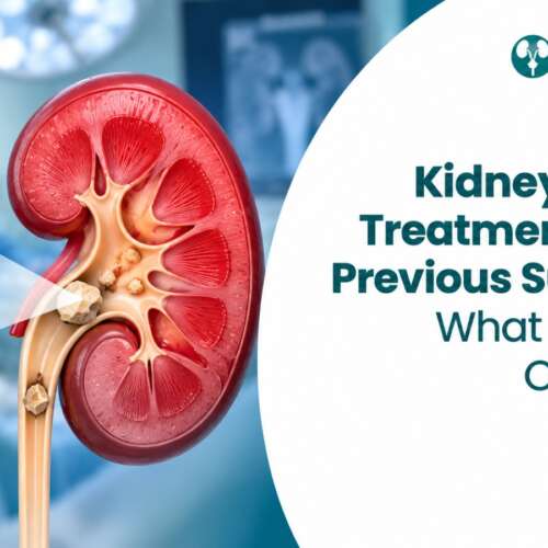 Kidney stone treatment options after previous surgery including RIRS Mini-PCNL and ECIRS